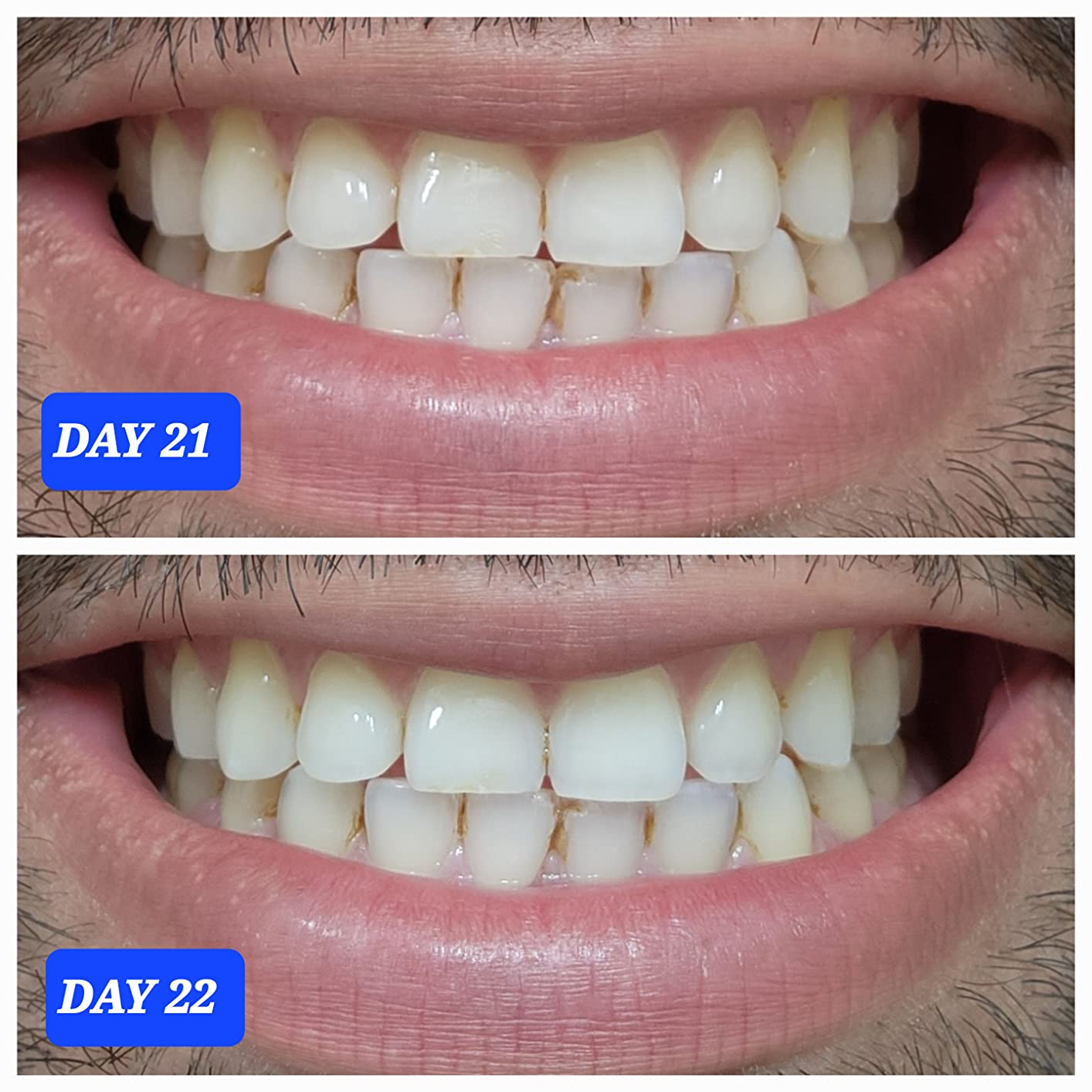 Crest 3D Whitestrips Professional Effects Teeth Whitening Kit, 22 Treatments (20 + 2 Bonus), 44 Strips customer photo 2
