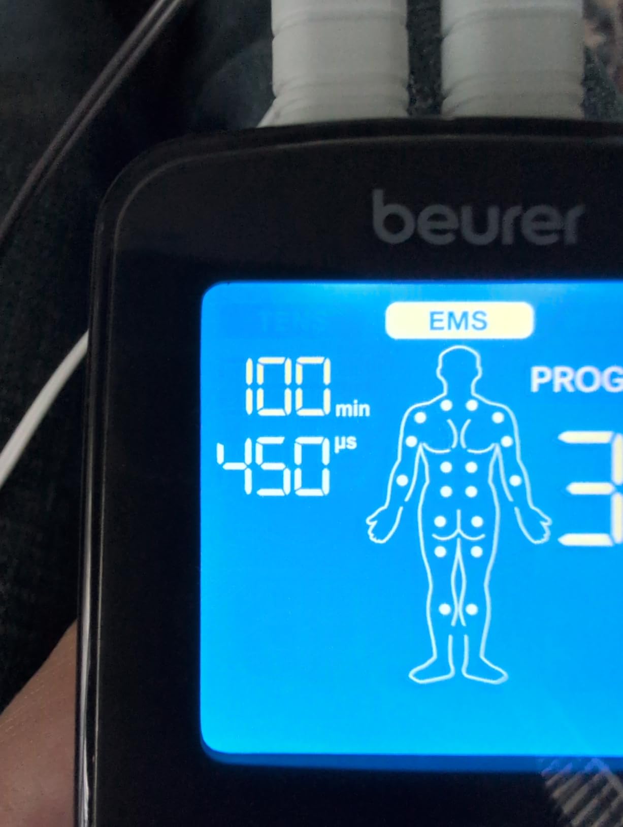 Beurer EM49 Digital TENS & EMS Device for Pain Relief and Muscle Stimulation, 15 TENS Programs, 35 EMS Programs, 2 Adjustable Channels with 4 Self-Adhesive Electrodes customer photo 1