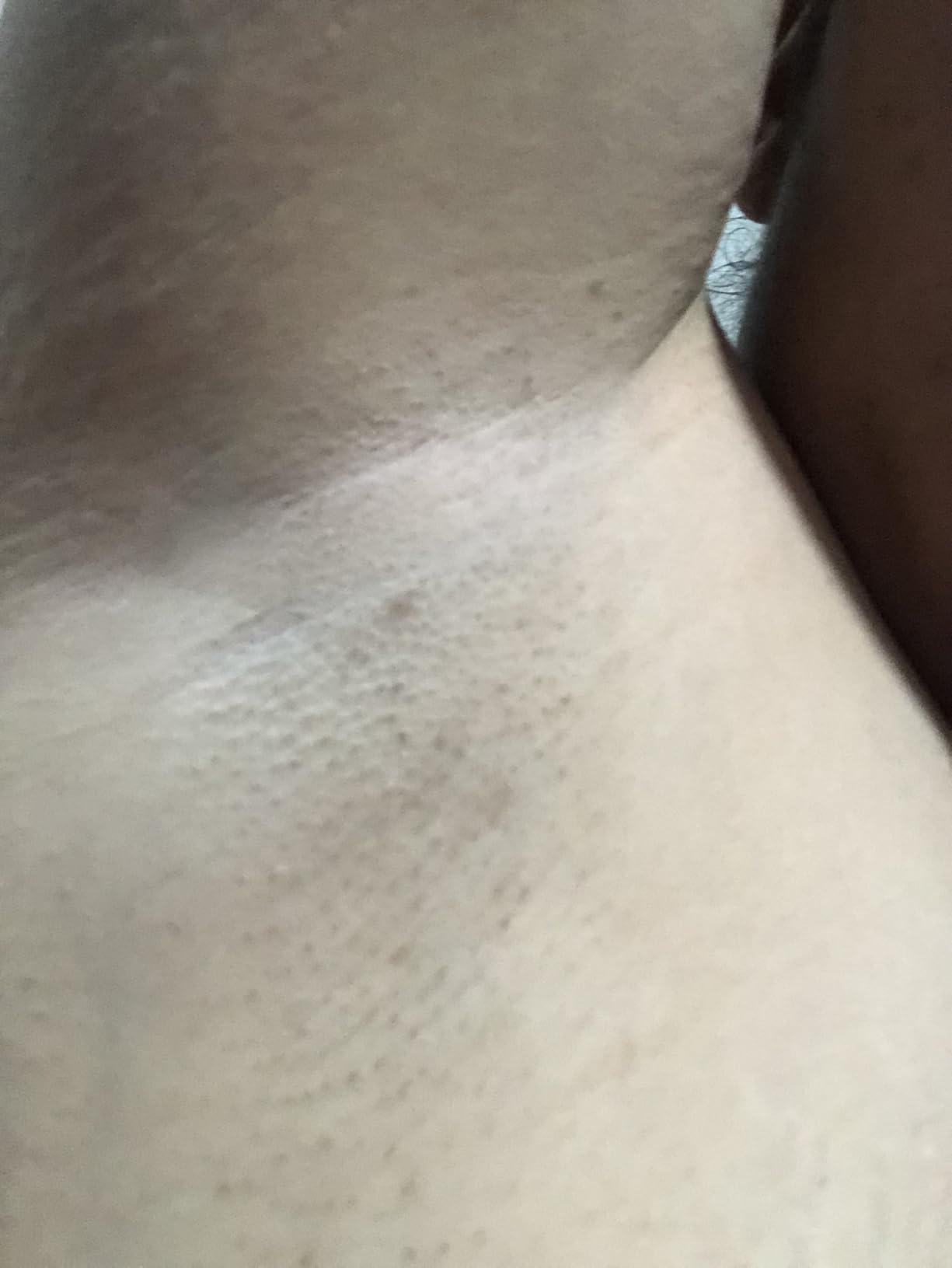 INNZA IPL Hair Removal with Ice Cooling Care Function for Women, Long-Lasting Results, 999,999 Flashes Painless Hair Removal Device customer photo 2