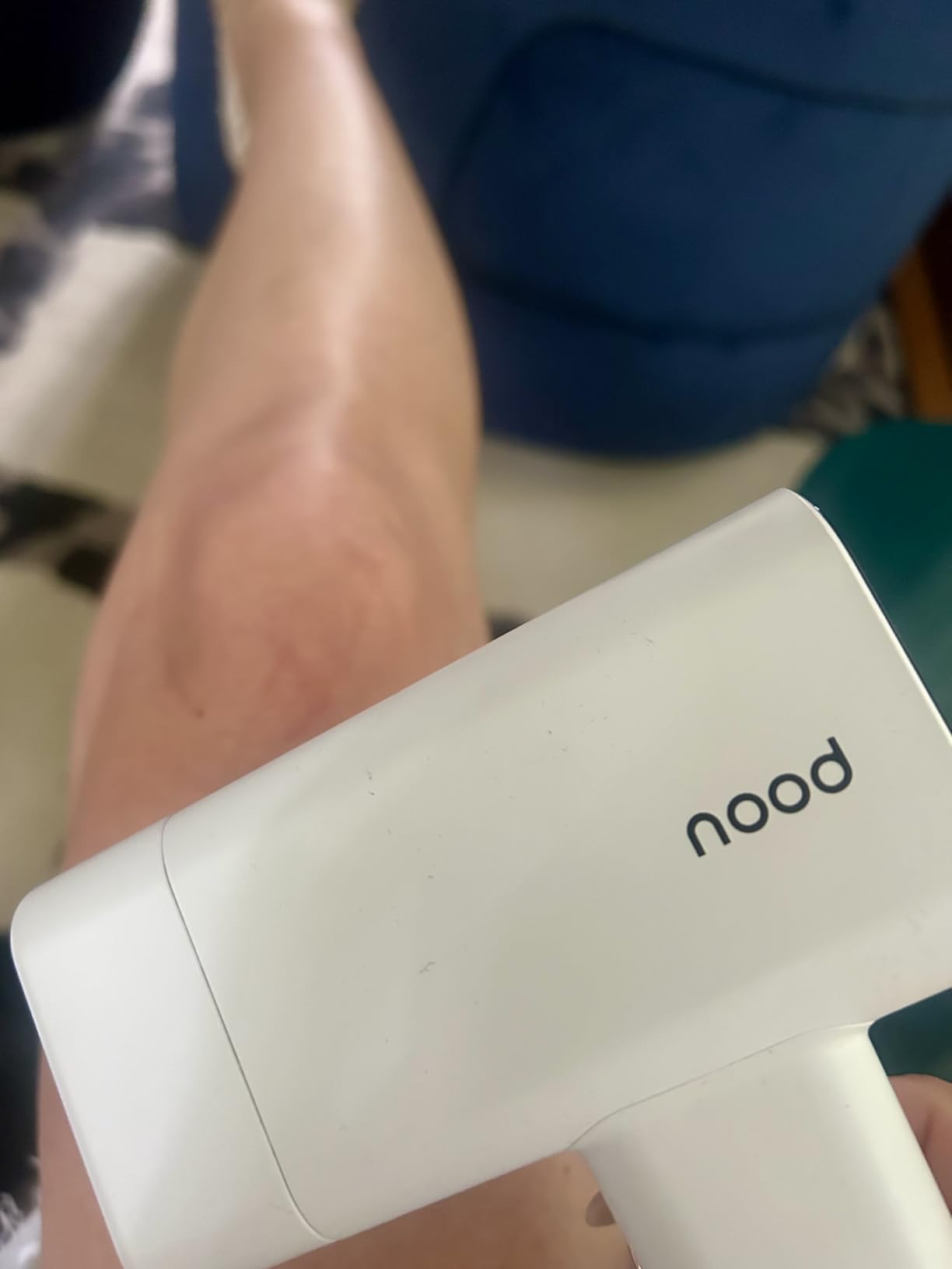 Nood Flasher Pro - Forbes Best Product 2026 - IPL Laser Hair Removal Device For At Home Use - Pain-Free, Permanent, Visible Results After First Use & Works Everywhere Hair Grows - Gloss White customer photo 1