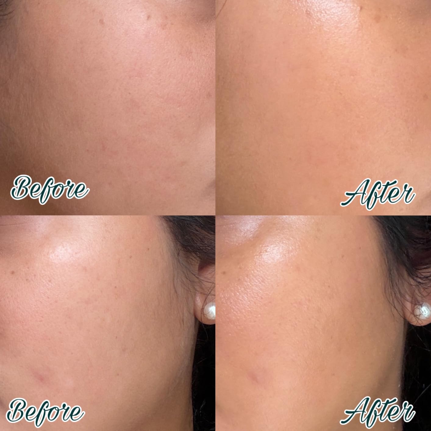 La Roche-Posay Anthelios Sunscreen SPF 40, Ultra-Light Fluid Broad Spectrum SPF 40, Face Sunscreen with Titanium Dioxide Mineral, Lightweight & Fast-Absorbing, Oil-Free, Matte Finish customer photo 2