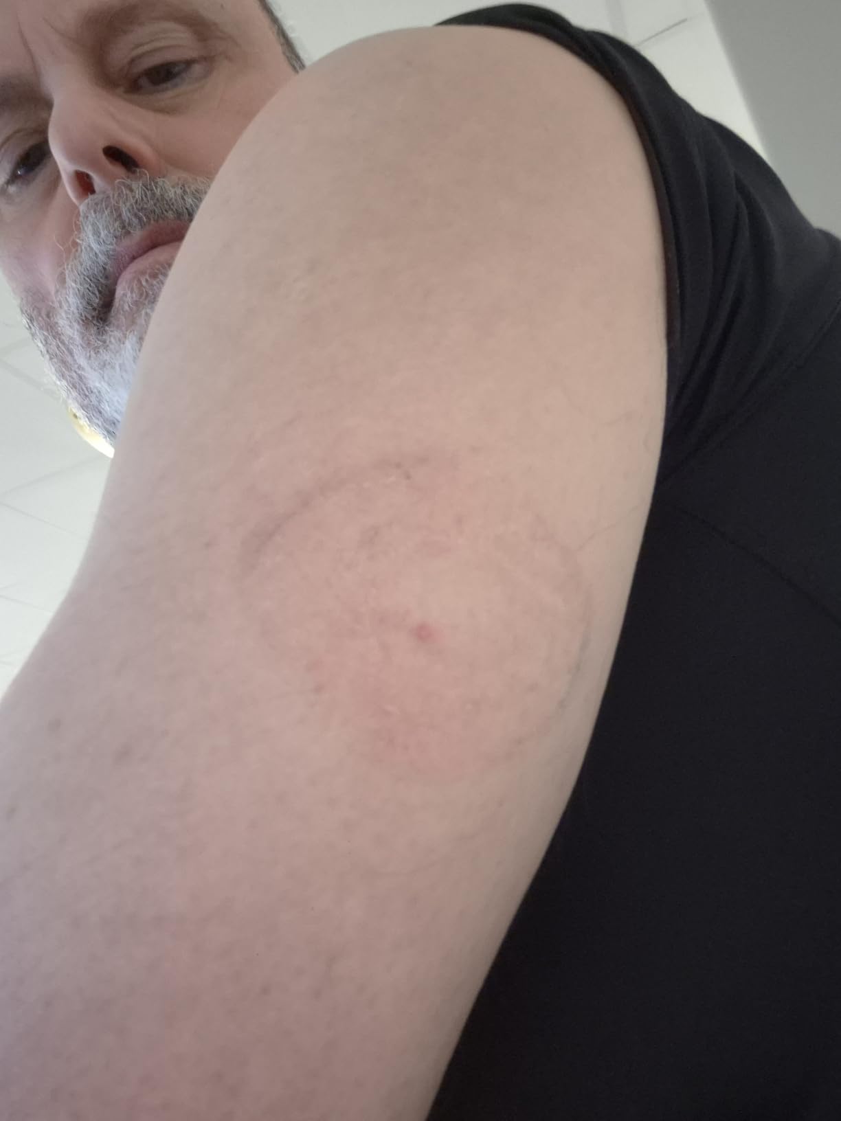 Stelo Glucose Biosensor & App by Dexcom - A Leader in Continuous Glucose Monitoring (CGM). 24/7 Tracking & Personalized Insights to Reveal Patterns. 2-Pack (Up to 15 Days Each). iOS & Android. customer photo 2