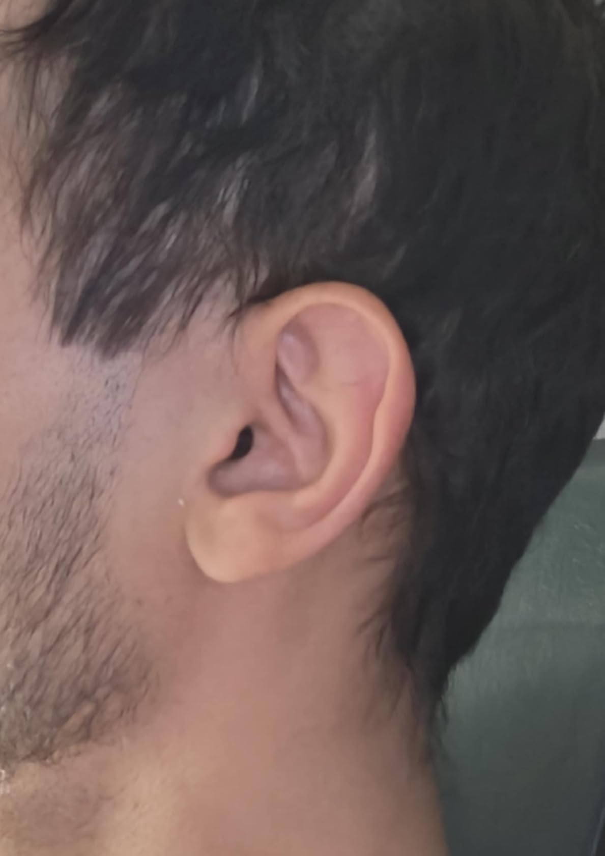 Eargo SE Self-Fitting FDA-Cleared OTC Adult Hearing Aids - Virtually Invisible CIC, Rechargeable, Award-Winning Customer Support customer photo 1