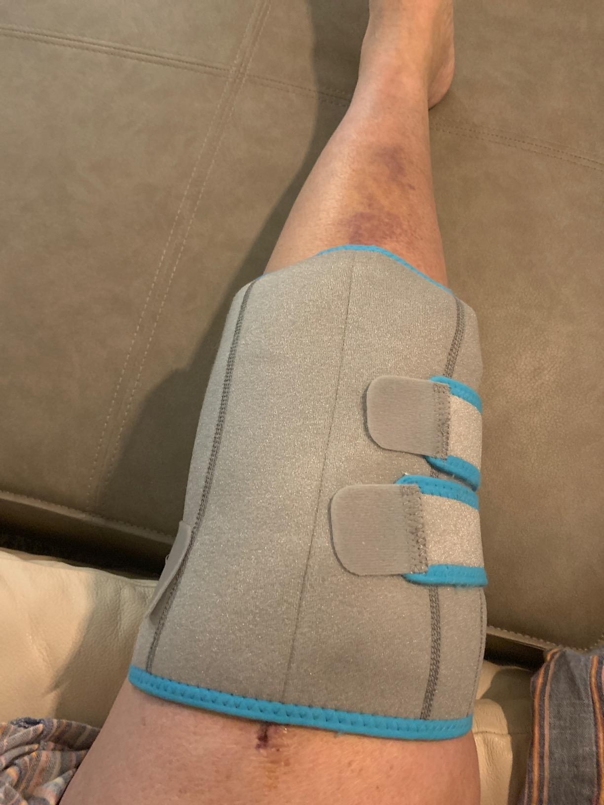 Vive Knee Ice Pack Wrap - Cold/Hot Gel Compression Brace for Pain Relief customer photo 1