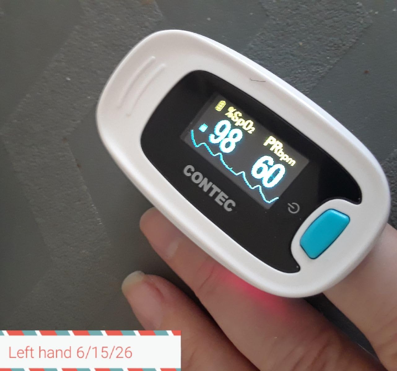 CONTEC Pulse Oximeter, SpO2 & PR Waveform Blood Oxygen Monitor w/Lanyard customer photo 1