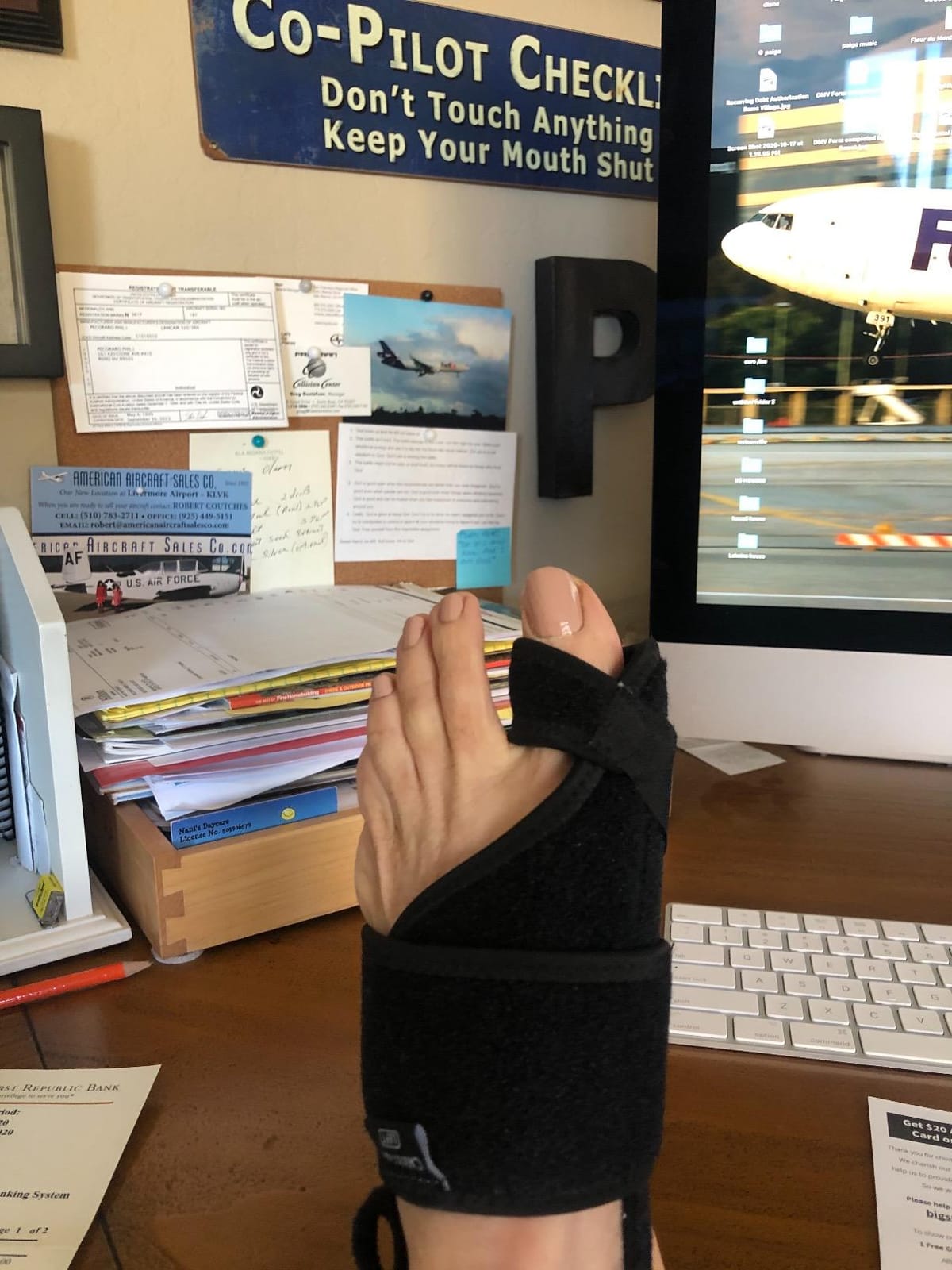 Caretras 2-Pack Bunion Corrector for Women & Men, Orthopedic Bunion Splint for Hallux Valgus Pain Relief, Big Toe Separator, Adjustable Day/Night Support, Comfortable Hammer Toe Straightener customer photo 1