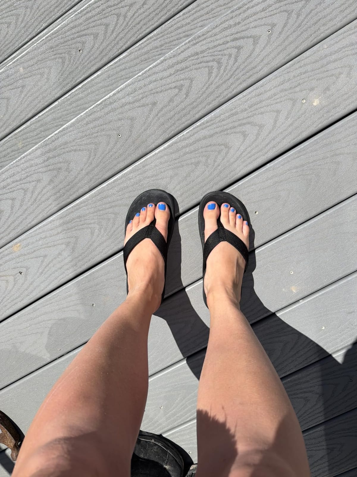 LLSOARSS Plantar Fasciitis Feet Sandal with Arch Support - Best Orthotic flip Flops for Flat Feet, Heel Pain- for Women customer photo 1