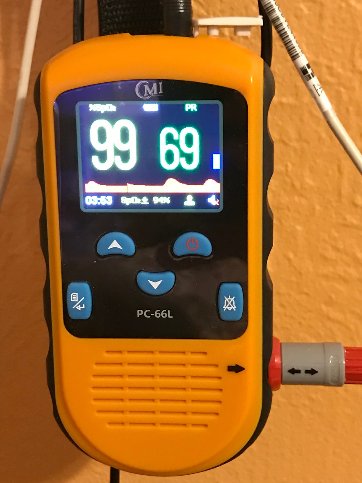 CMI Health Rechargeable Finger Pulse Oximeter for Adults, Continuous SpO2 & Pulse Rate Readings, Spot Check Mode, Adjustable Alerts, Ideal for Sports, Aviation & Wellness, Carry Case and AC Adapter Included customer photo 1