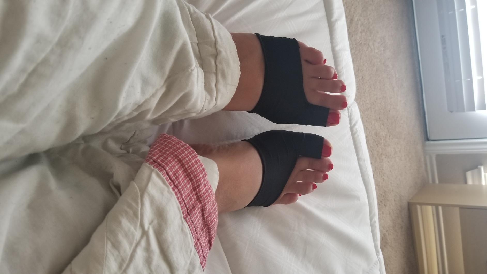 Copper Compression Bunion Corrector Relief Sleeve - Gel Cushion Pads - Copper Infused - Orthopedic Brace Big Toe Alignment - Hallux Valgus Relief - Straightener Spacer Fit for Women & Men - 1 Pair customer photo 1