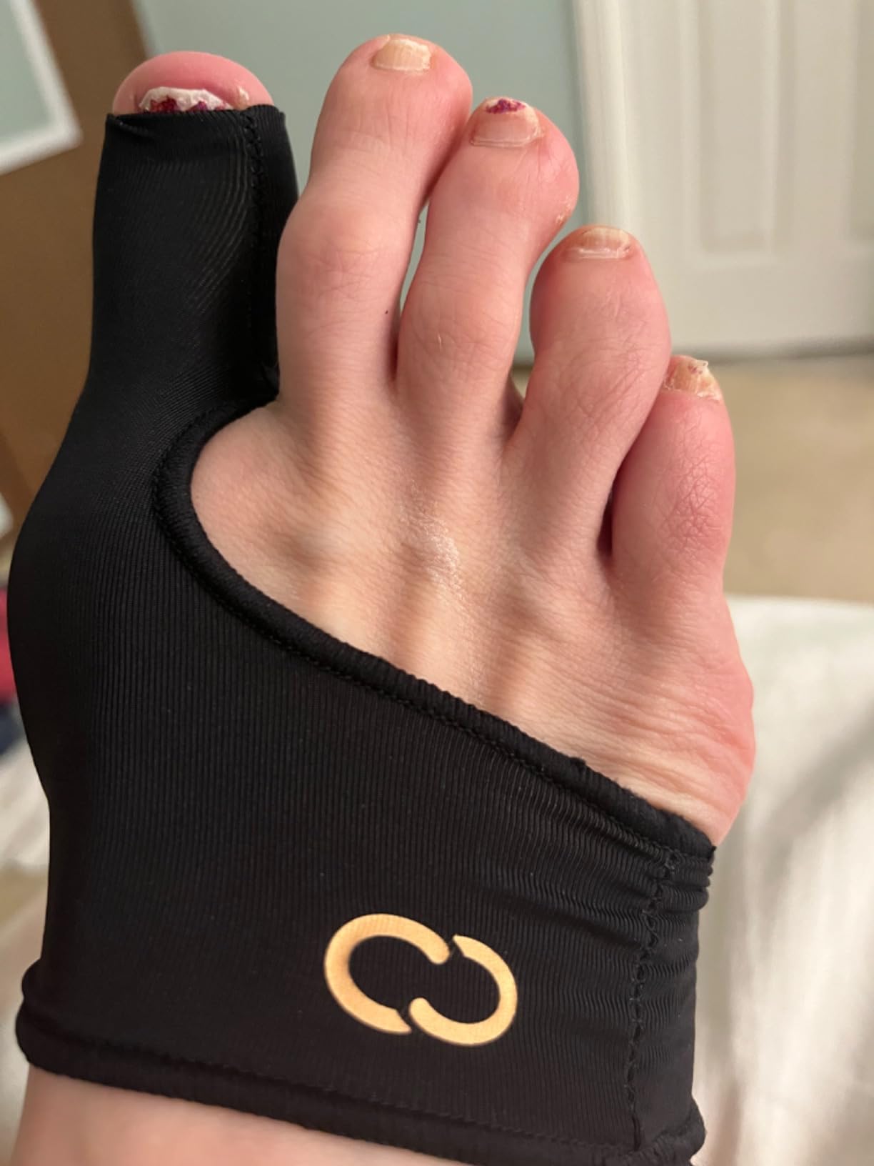 Copper Compression Bunion Corrector Relief Sleeve - Gel Cushion Pads - Copper Infused - Orthopedic Brace Big Toe Alignment - Hallux Valgus Relief - Straightener Spacer Fit for Women & Men - 1 Pair customer photo 2