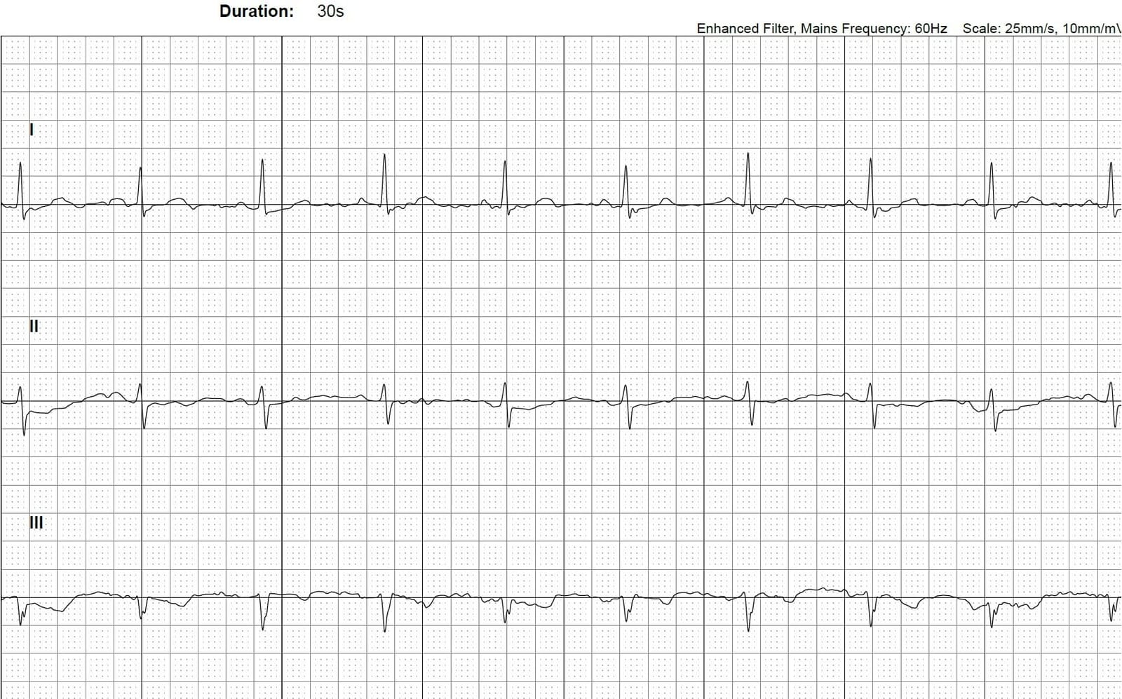 KardiaMobile 6-Lead Personal EKG Monitor - Six Views of The Heart - Detects AFib and Irregular Arrhythmias - Instant Results in 30 Seconds - Works with Most Smartphones - FSA/HSA Eligible customer photo 2