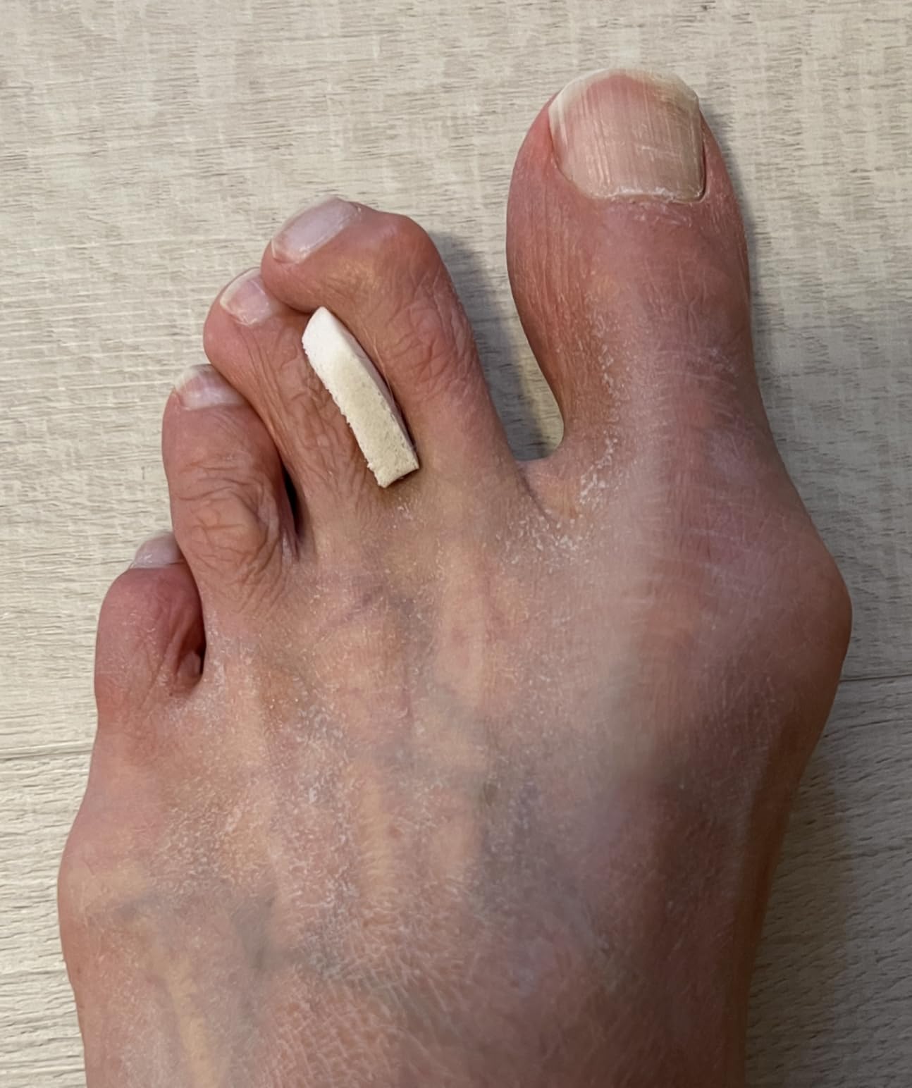 Foam Toe Separators for Women and Men, Made in USA 1/4 Inch, 50 Pack | Toes Spacers for Corn Relief, Blister Relief, Hammer Toe Relief customer photo 2