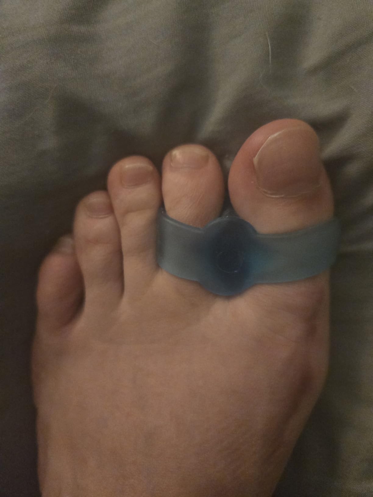 Welnove Pack of 12 Bunion Corrector, Toe Separators with 2 Loops, Big Toe Spacer Suitable for Bunion and Overlap Toe (White) customer photo 2