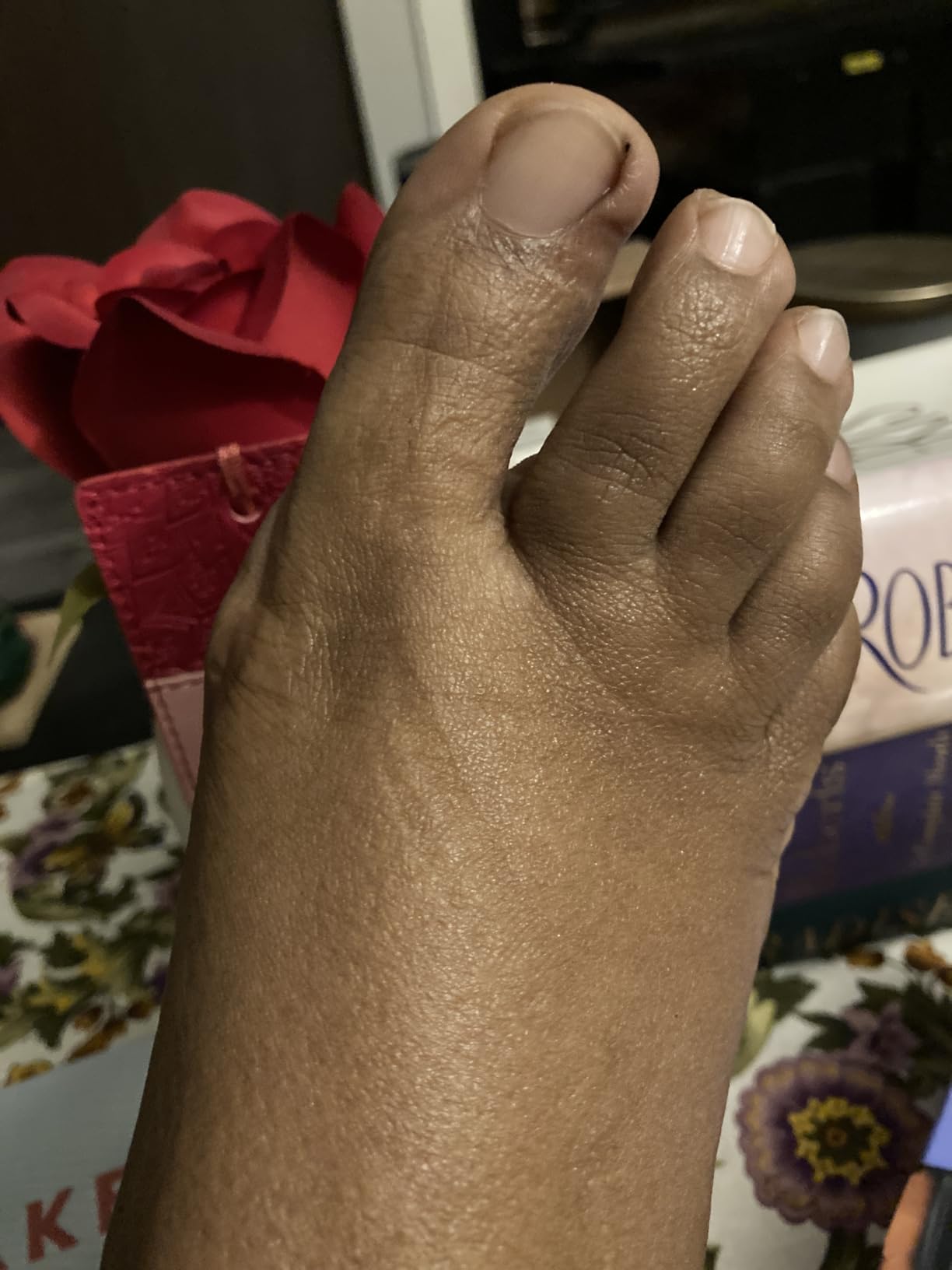 Dr. Scholl's BUNION RELIEF & TOE CORRECTOR // Massaging Gel Bunion Splint & Big Toe Straightener - Orthopedic Bunion Corrector for Women & Men - Bunion Pads for Bunion Pain Relief, 1 Support Set (Left & Right) customer photo 2