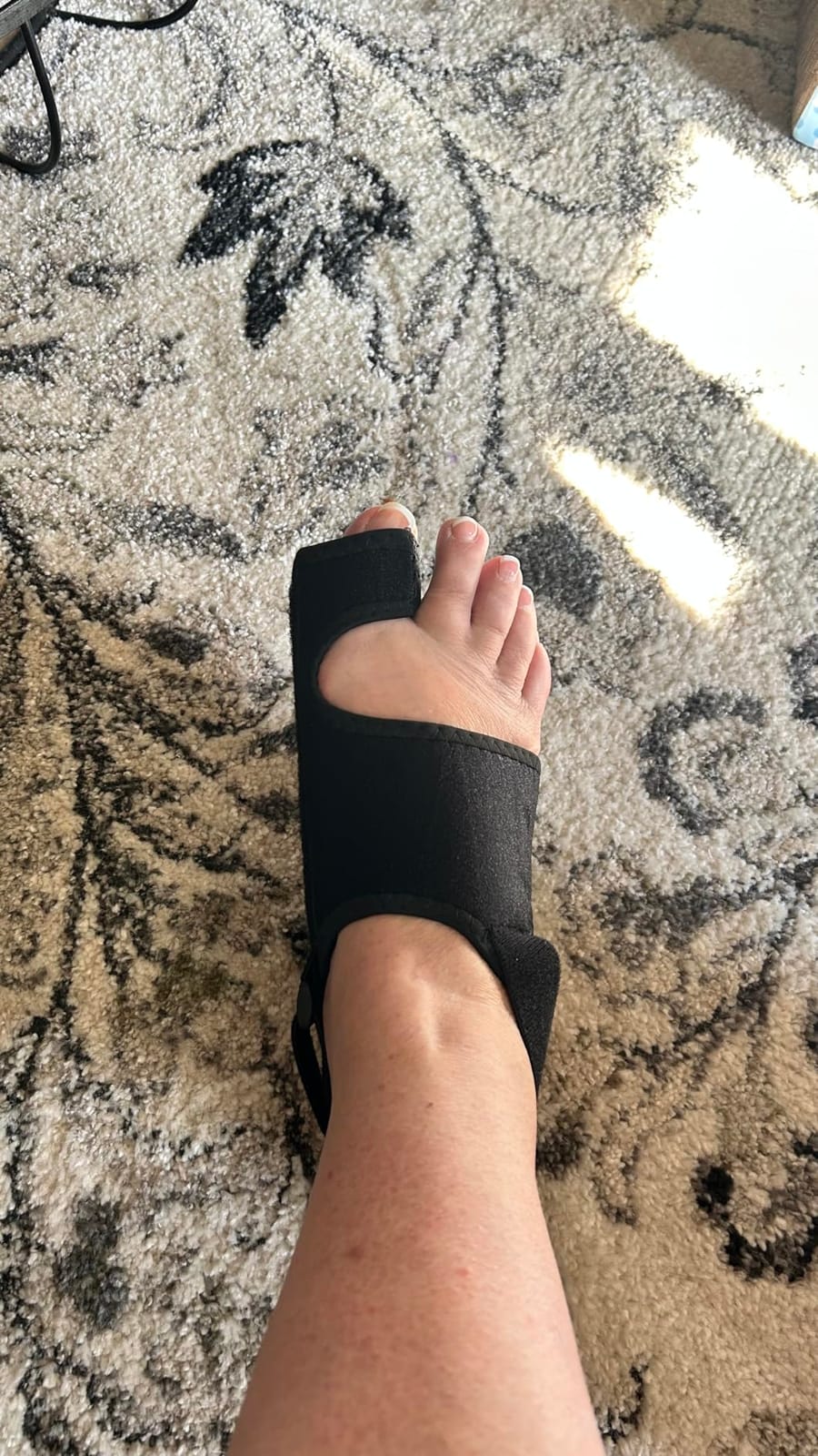 MOONSMILE 1 Pair Foot Bunion Corrector for Women & Men, Night Bunion Splint, Big Toe Straightener, Foot Gear Bunion Brace for Pain Relief customer photo 2