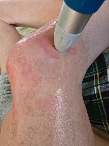 Professional Shockwave Therapy Machine ESWT,T800 | Efficient Pain Relief for Joint, Muscle, Shockwave Therapy for Back ,Shoulder, Golfer's Elbow, Rotator Cuff Pain customer photo 2