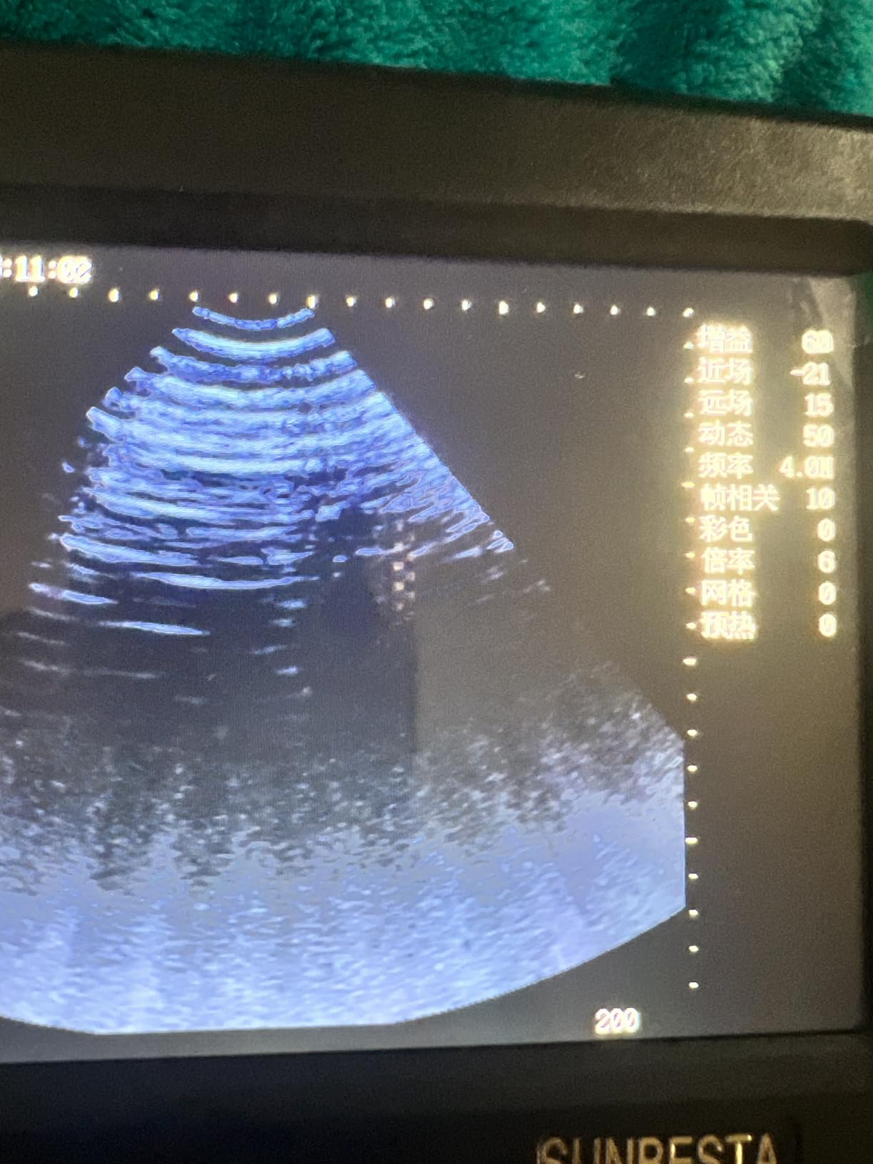 A8 Portable Veterinary Ultrasound Machine for Pregnancy Check,5.7