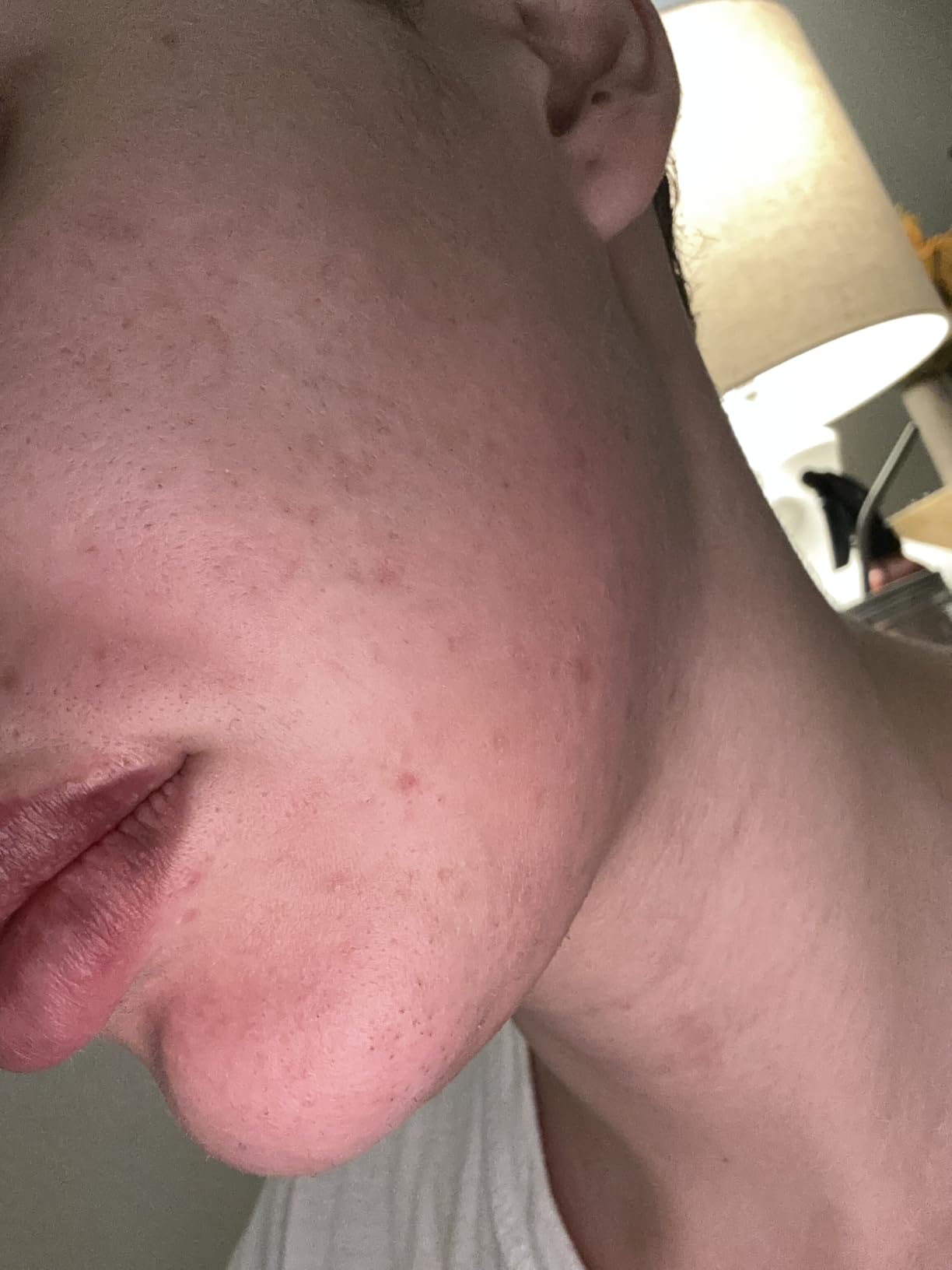Radio Frequency Skin Tightening Device, Anti-Aging Face Machine for Wrinkle Removal, Lifting & Firming, Wireless Home Beauty Device with 3 Levels, at-Home Skin Renewal customer photo 2