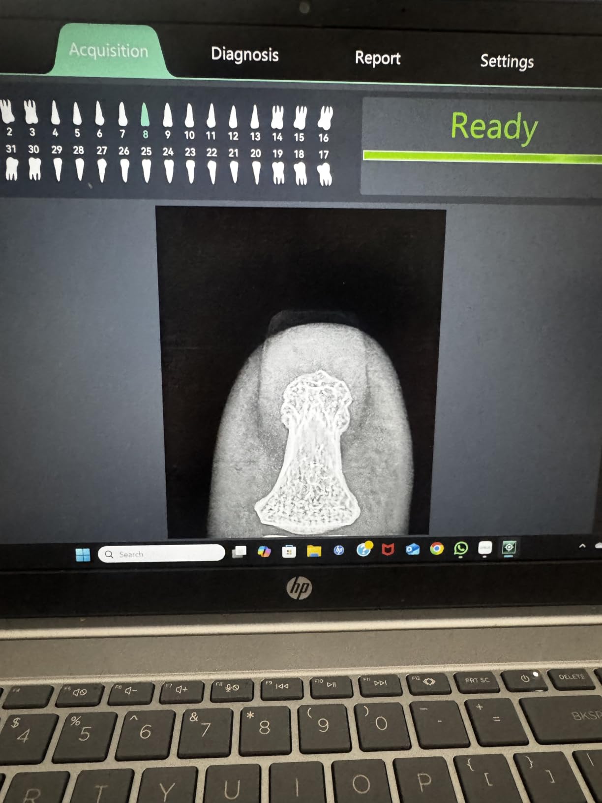 Dental X-Ray Sensor Veterinary Radiovisograph HD Digital Intraoral Imaging System Portable X Ray Digital Sensor (1.5 (25x30mm)) customer photo 1