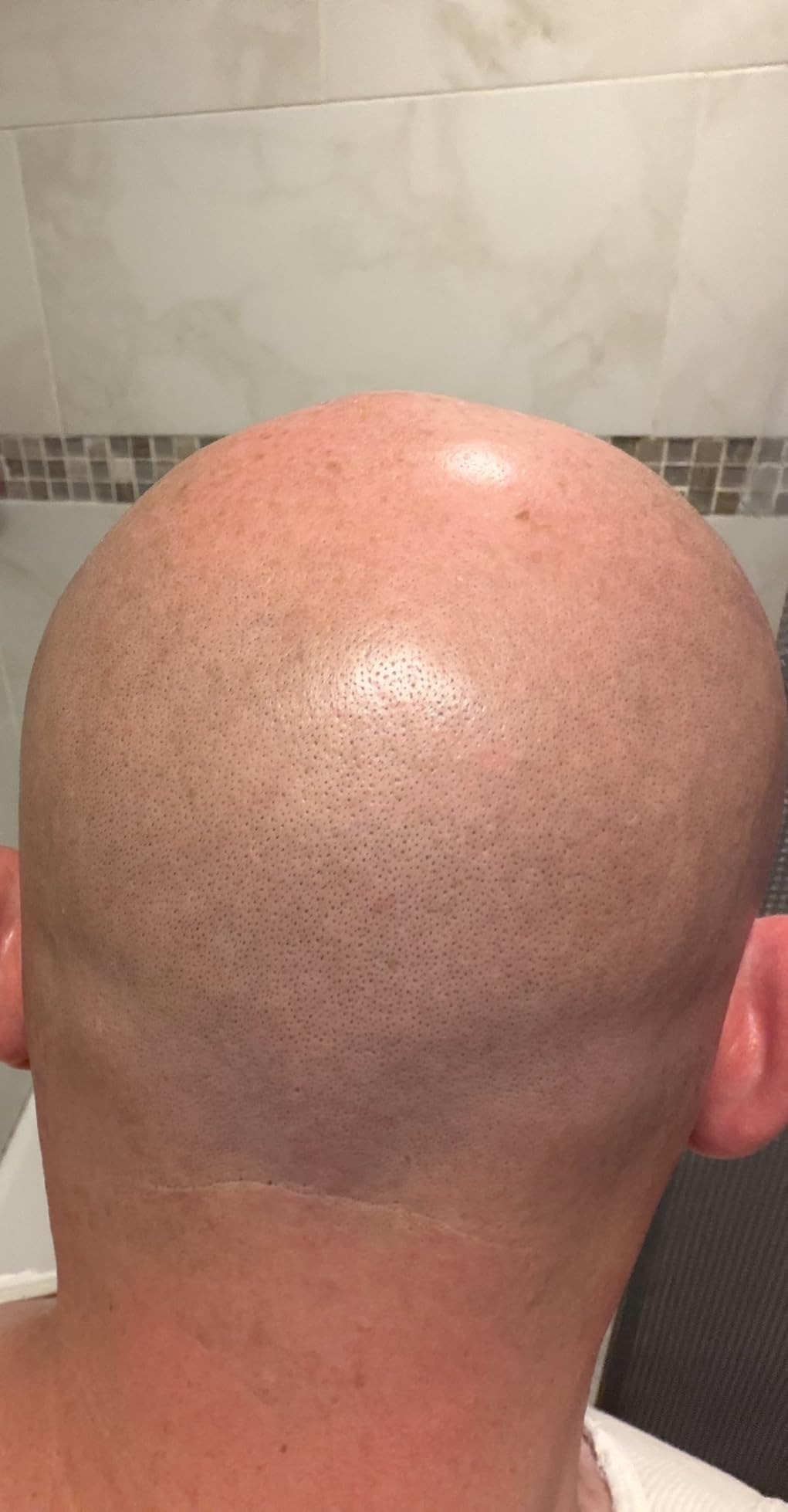 Philips Norelco Head Shaver Pro 7000 Series (HS7980/40), 360° Flexing Head with ComfortCut Blades and PowerAdapt Sensor customer photo 2