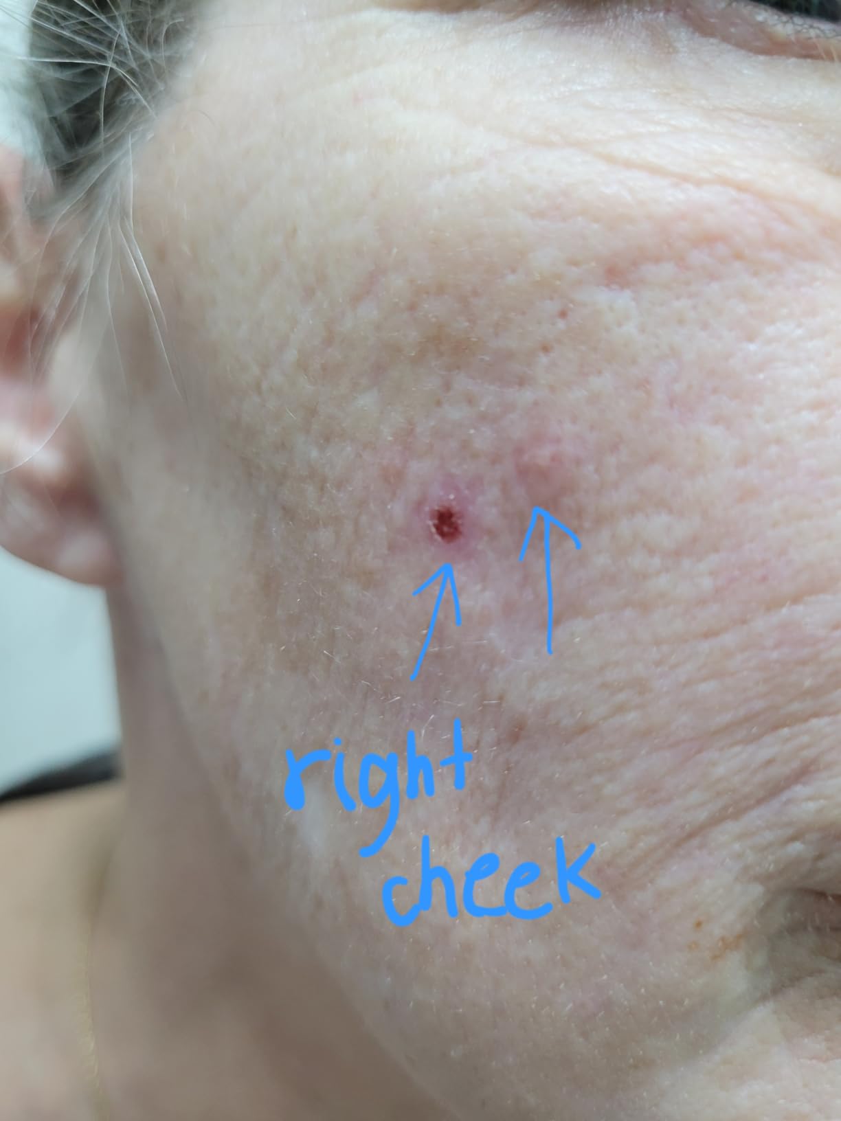 CeraVe Resurfacing Retinol Serum customer photo 1