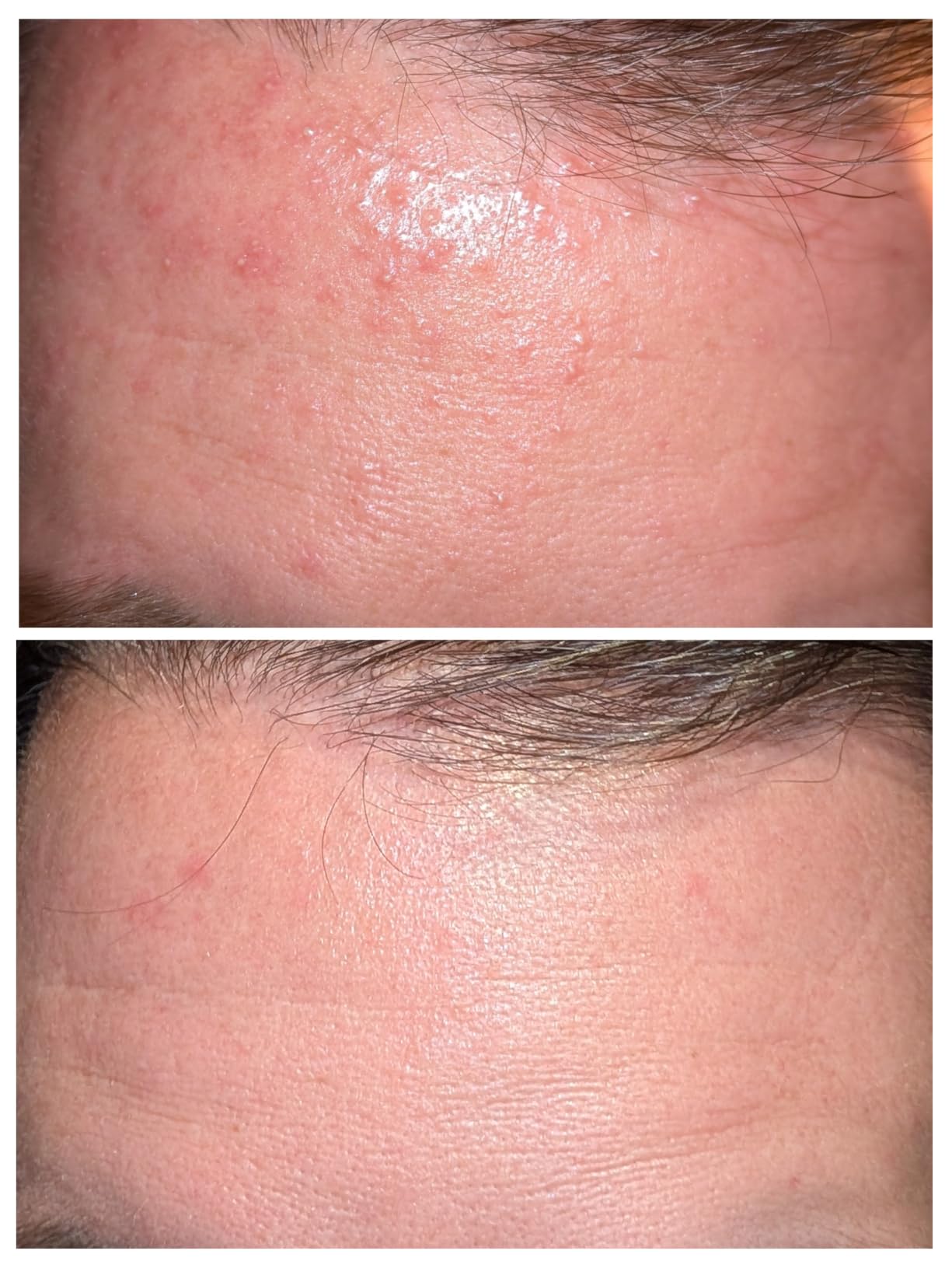 CeraVe Resurfacing Retinol Serum customer photo 2