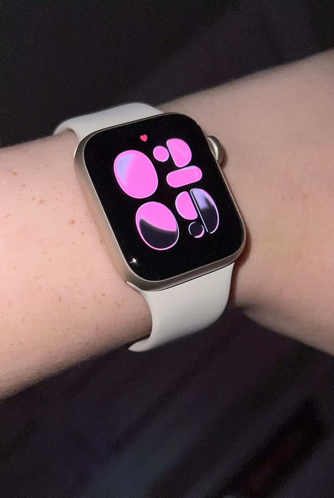 Apple Watch SE 3 customer photo 2